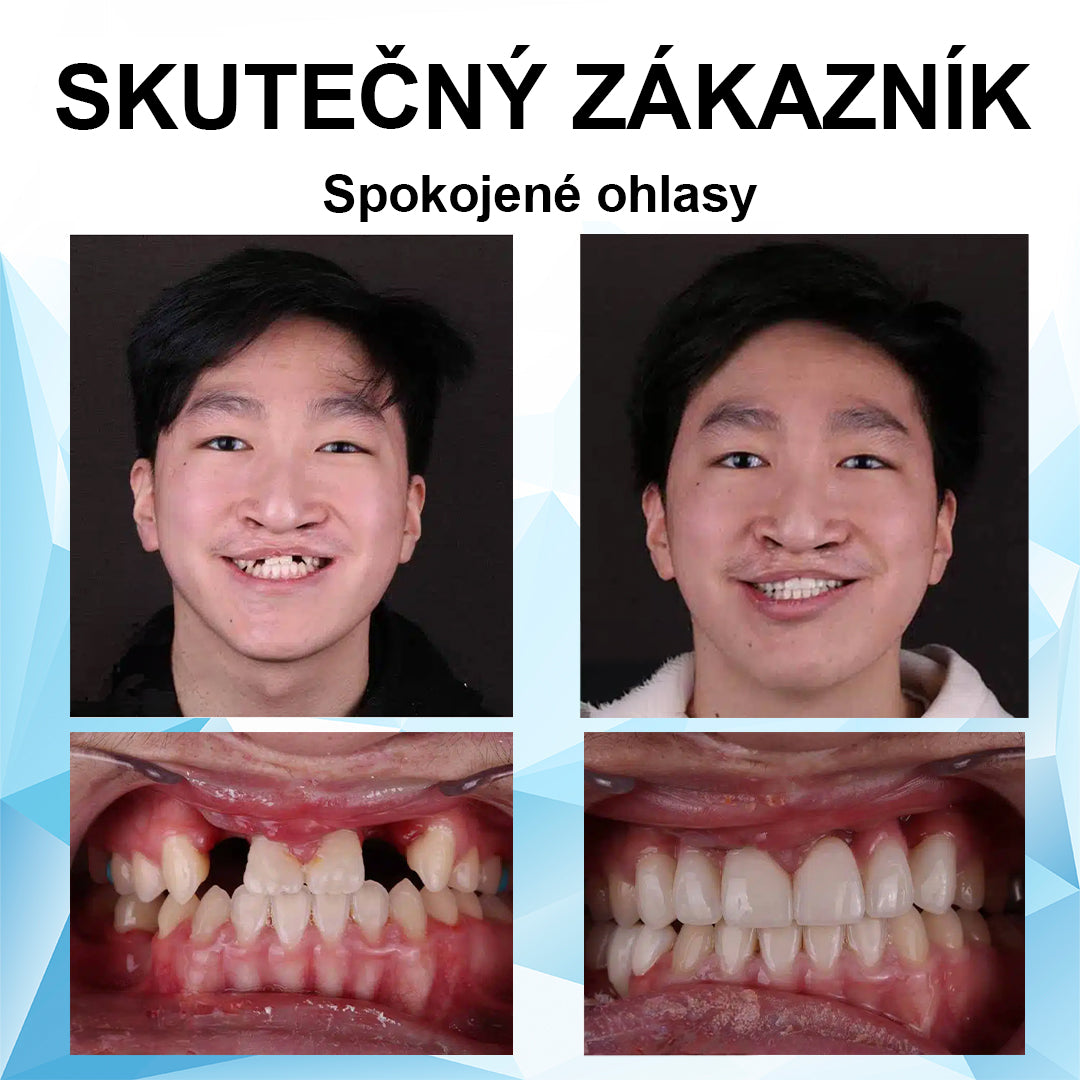 👍 [ADA doporučuje] 🌿🦷Oralhoe™ Silikonová reline sada zubních protéz