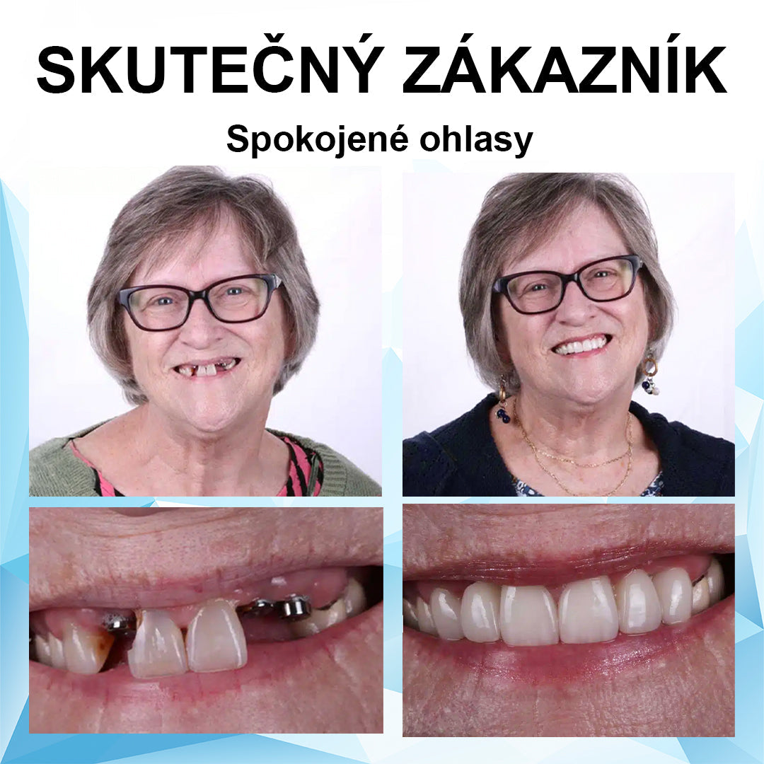 👍 [ADA doporučuje] 🌿🦷Oralhoe™ Silikonová reline sada zubních protéz