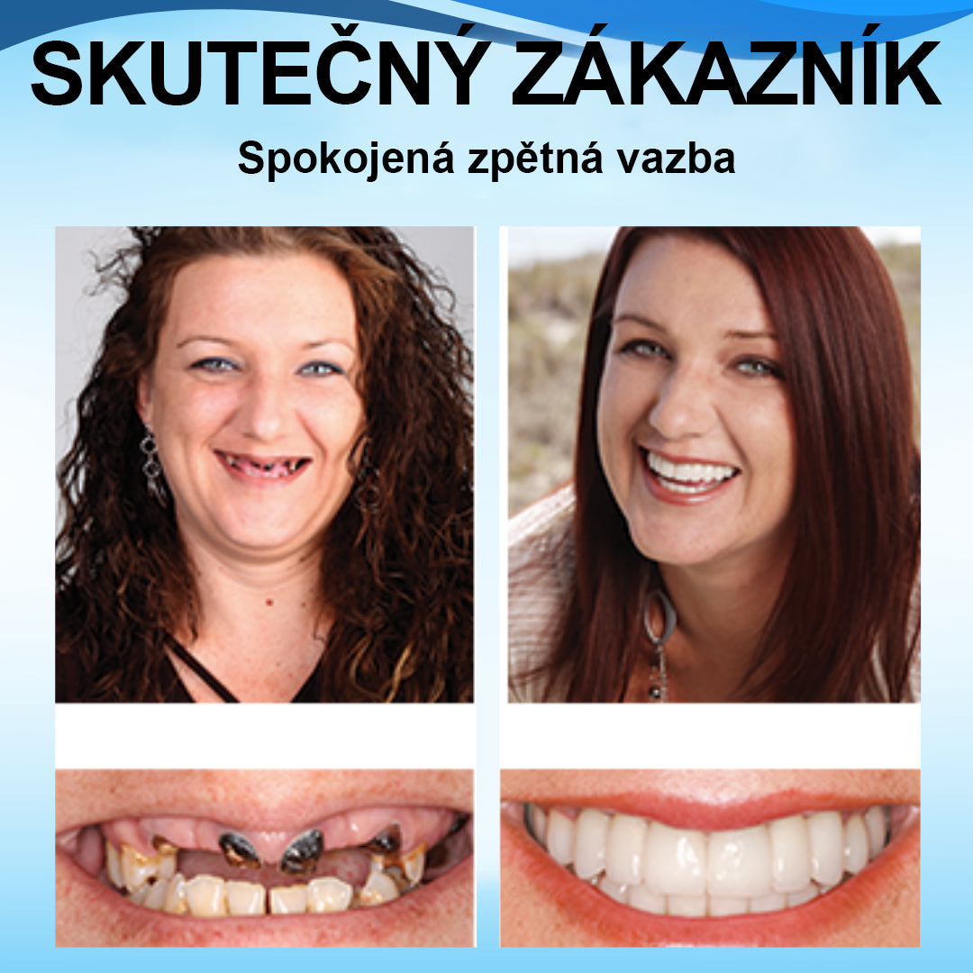 👍 [ADA doporučuje] 🌿🦷Oralhoe™ Silikonová reline sada zubních protéz